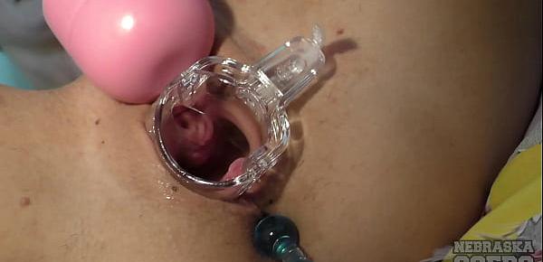  dp anal toy with speculum opening up young fresh brunettes vagina